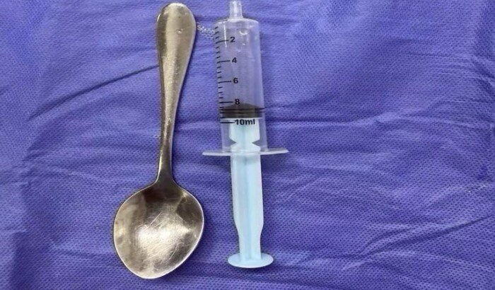 بلعت ملعقة شاي.. فريق طبي ينقذ سيدة عمرها 77 عامًا في المنوفية